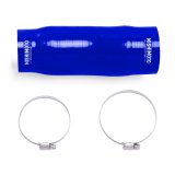 Mishimoto 2016+ Honda Civic 1.5L Blue Silicone Induction Hose Kit thumbnail 1