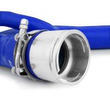 Mishimoto 06-10 Chevy Duramax 6.6L 2500 Blue Silicone Hose Kit thumbnail 4