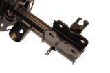 KYB Shocks & Struts Excel-G Front Right Nissan Altima 2013 thumbnail 8