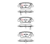 DBA 18-23 Hyundai Accent Rear SSEV Street Series Brake Pads thumbnail 1